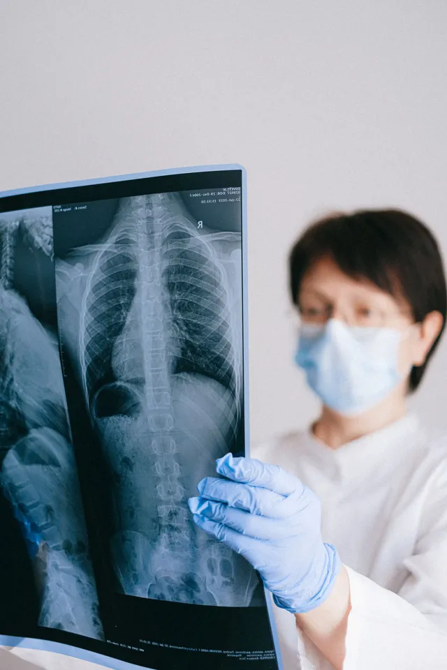 Profesional de la salud con tapabocas revisando una radiografía